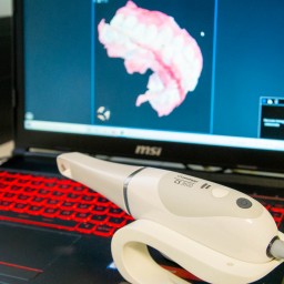 Carestream CS 3600